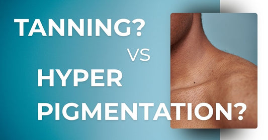 Tanning vs. Hyperpigmentation: What Niconi Tan Vanish Gluta-Kojic Skin Polish Actually Treats