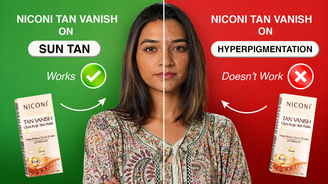 Does Niconi Tan Vanish Work on Hyperpigmentation?