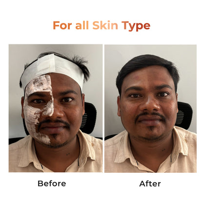 Niconi Tan Vanish Gluta-Kojic Skin Polish | Instant Tan Removal in under 20 minutes!