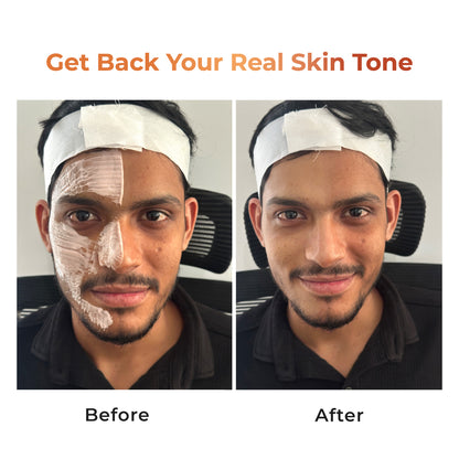 Niconi Tan Vanish Gluta-Kojic Skin Polish | Instant Tan Removal in under 20 minutes!
