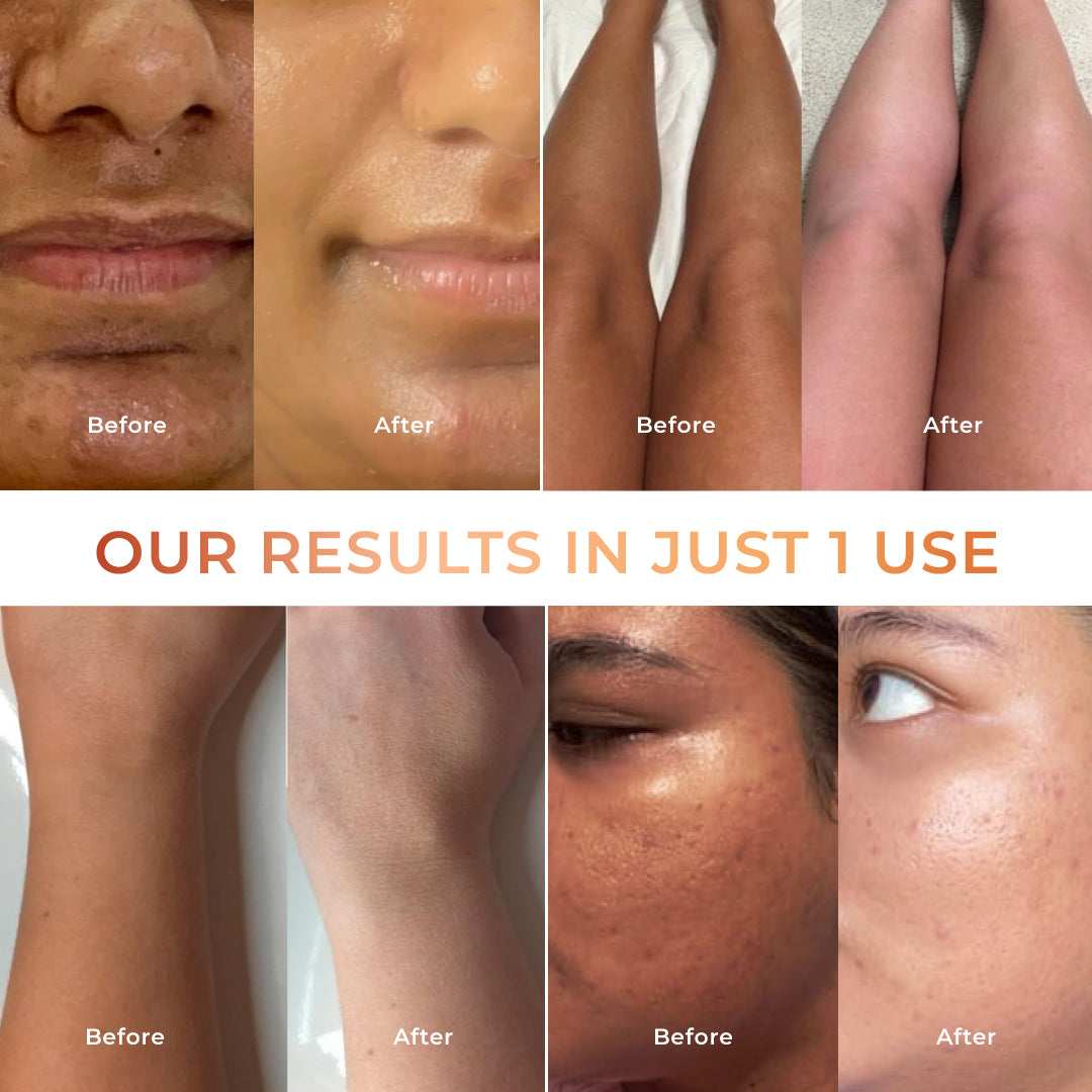 Niconi Tan Vanish | Buy 2 Get ₹1000 OFF