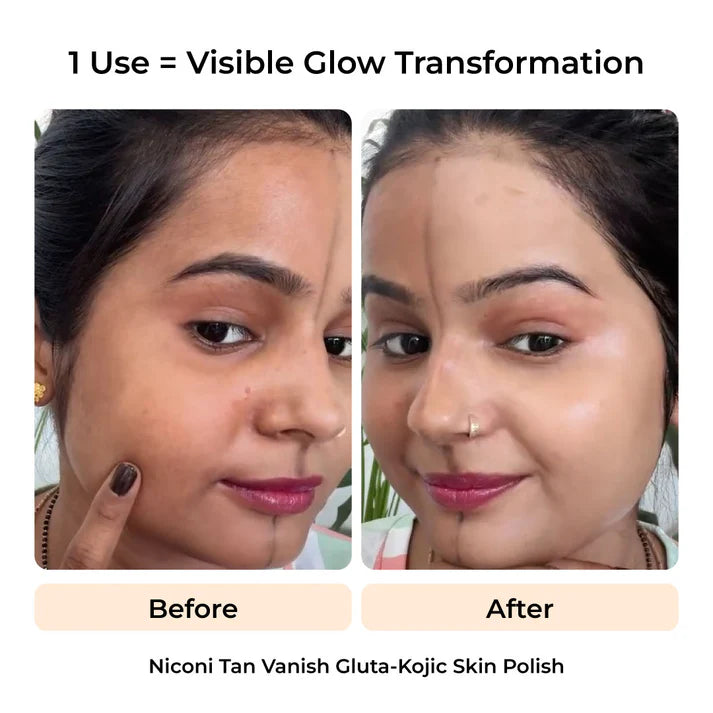 Tan Vanish & Herbal Hair Oil Combo