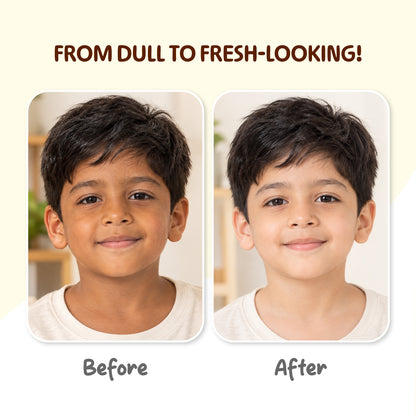 Niconi Lakadong Haldi Kids De-Tan Scrub For Face & Body-(300g) | 100% Safe