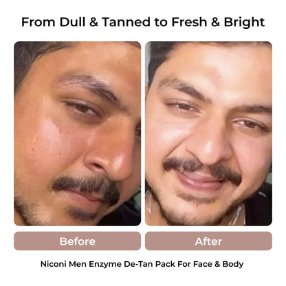 De-Tan & Herbal Hair Oil Combo