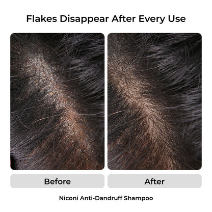 The Anti-Dandruff Hair Revival Combo
