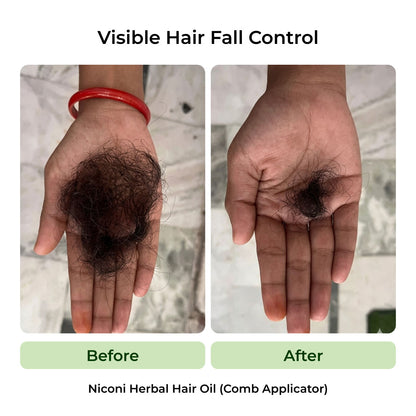 The Anti-Dandruff Hair Revival Combo