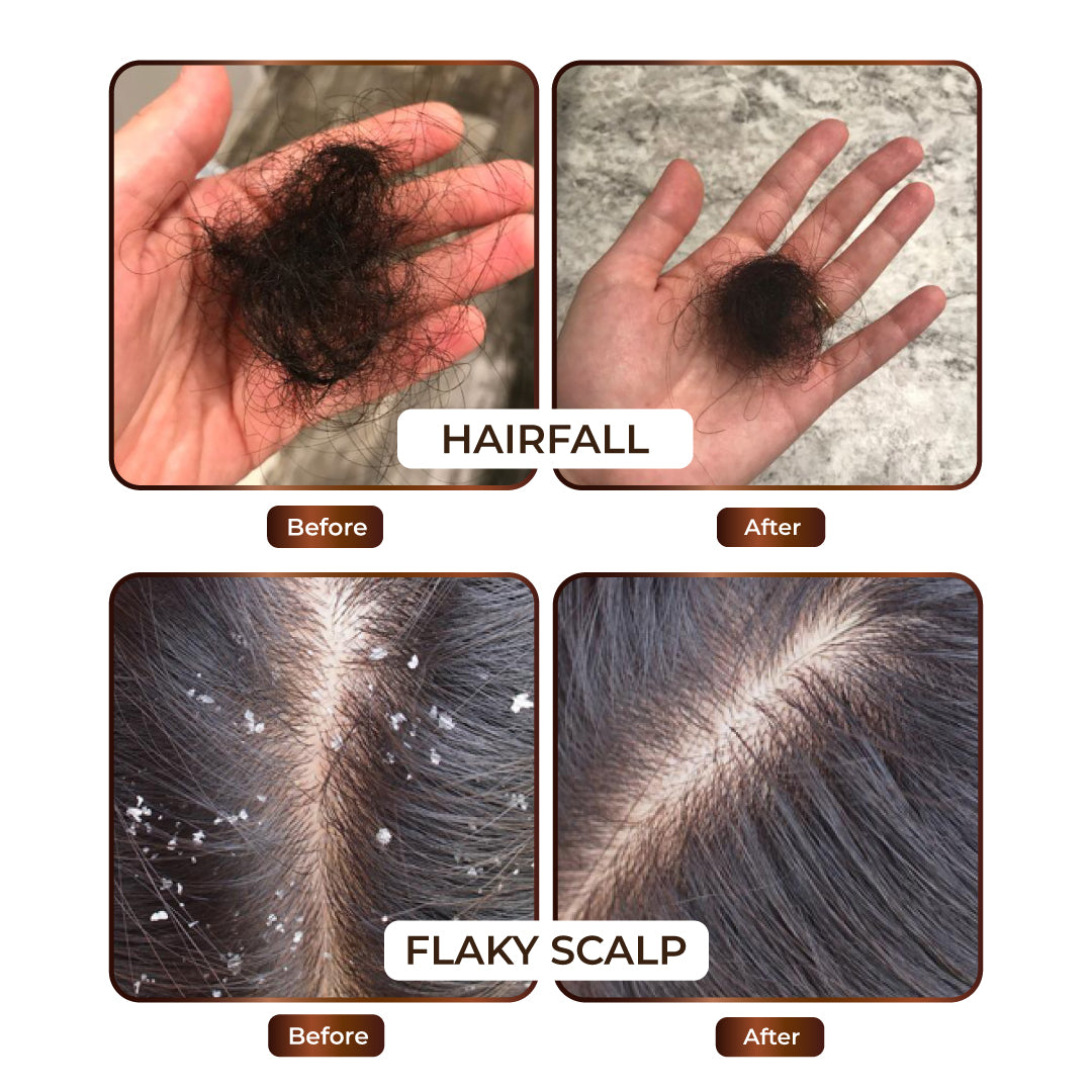 Niconi JADTATVA Herbal Hair Oil Spray