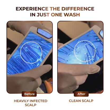 Niconi JADTATVA Herbal Hair Oil Spray