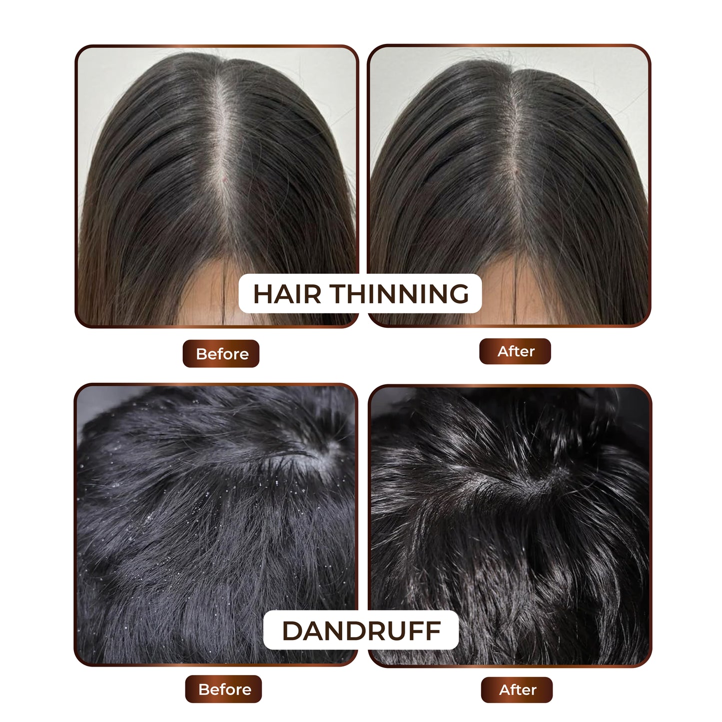 Niconi JADTATVA Herbal Hair Oil Spray