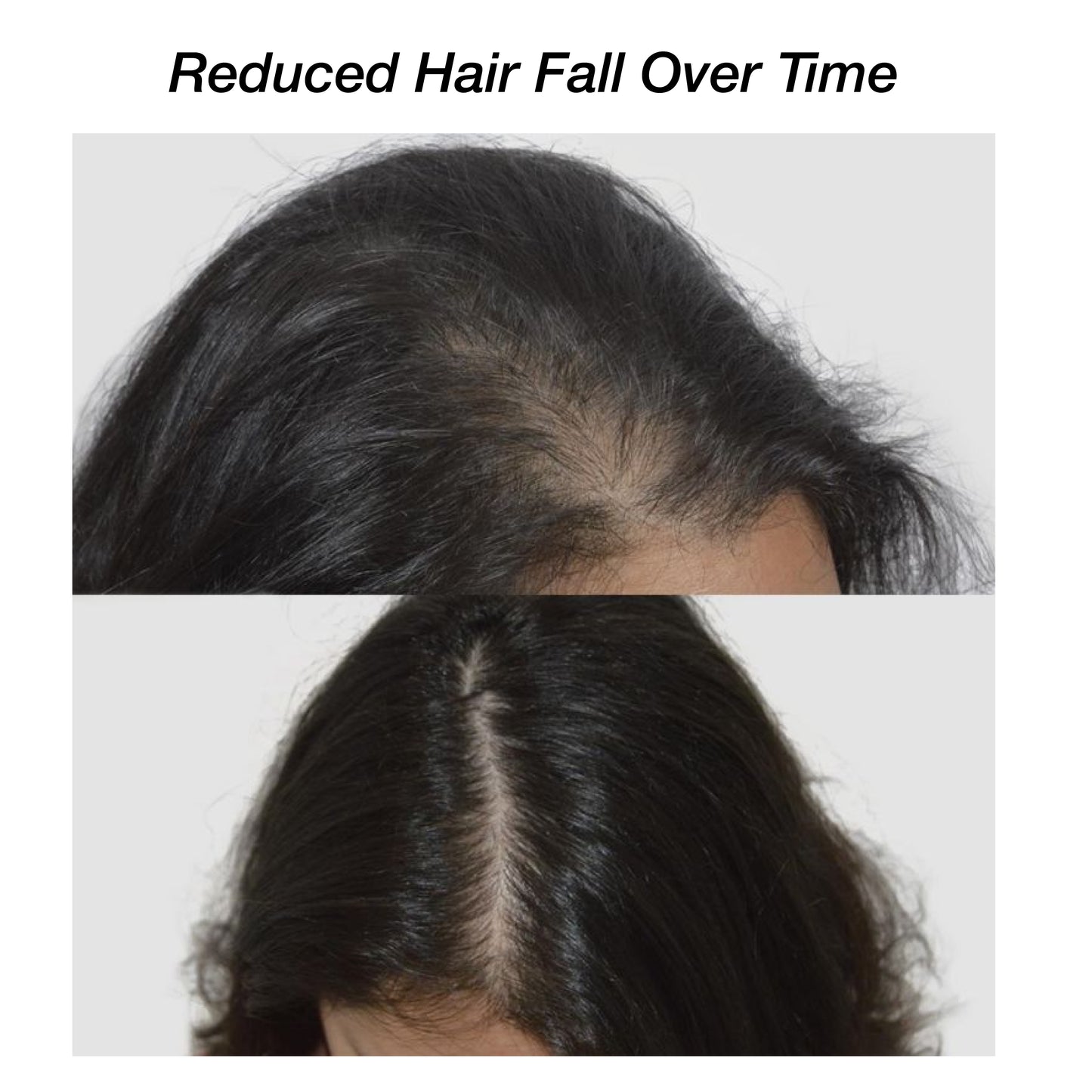 Niconi Herbal Hair (200ml) & Niconi Anti-Dandruff Shampoo (180ml) COMBO