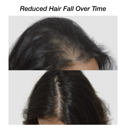 Niconi Herbal Hair (200ml) & Niconi Anti-Dandruff Shampoo (180ml) COMBO