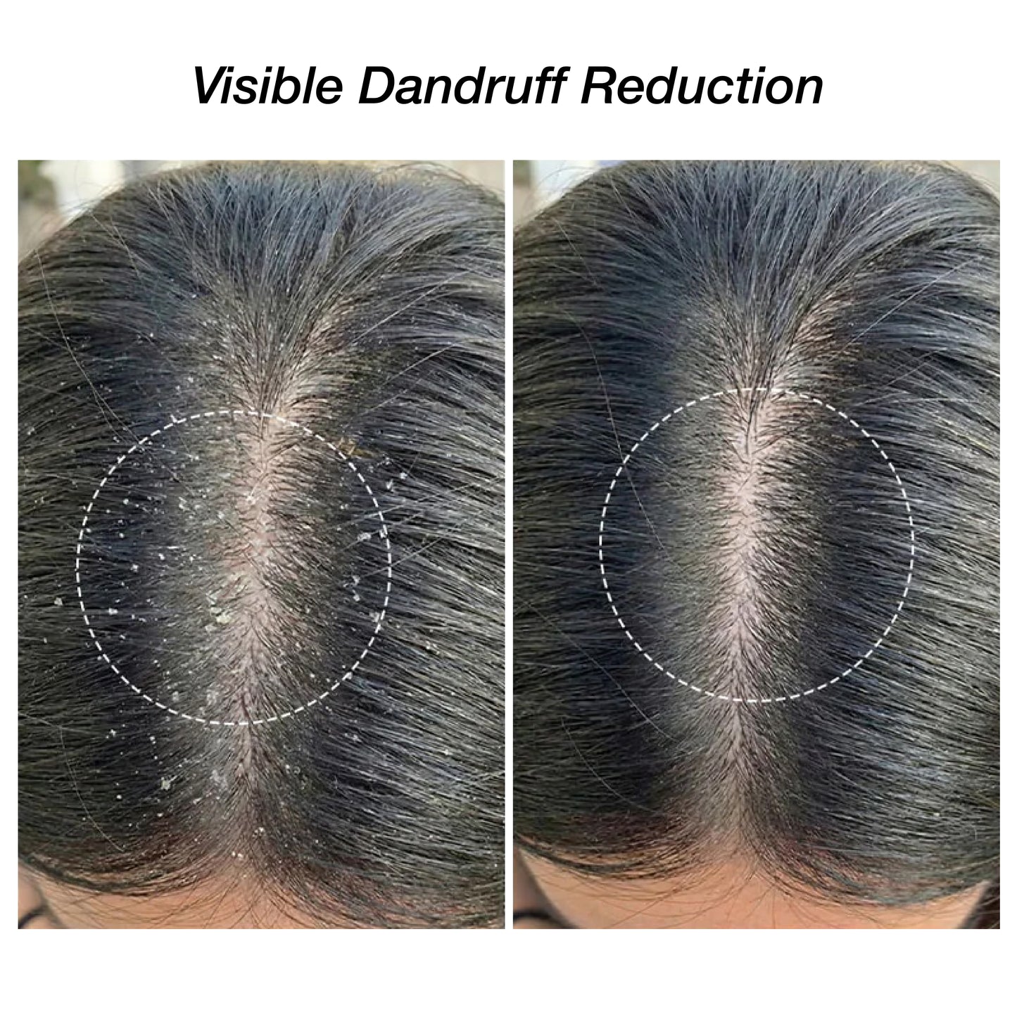 Niconi Herbal Hair (200ml) & Niconi Anti-Dandruff Shampoo (180ml) COMBO