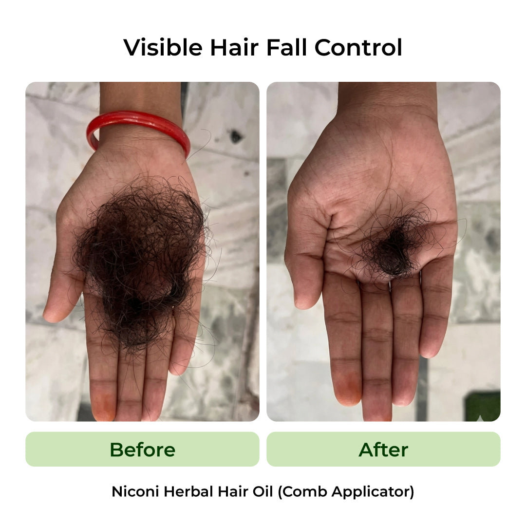De-Tan & Herbal Hair Oil Combo