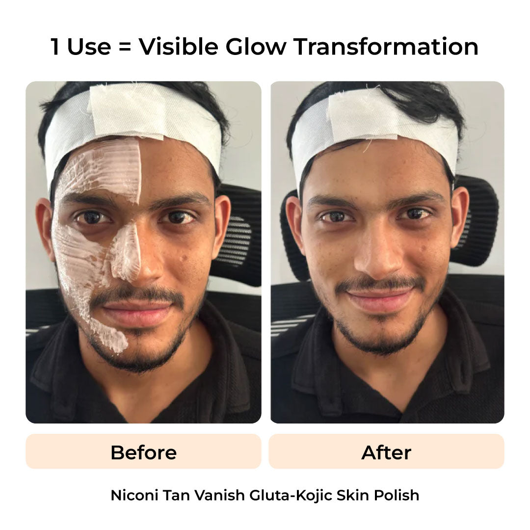 The Ultimate De-Tan Combo for Men