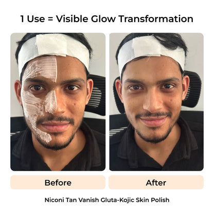 The Ultimate De-Tan Combo for Men