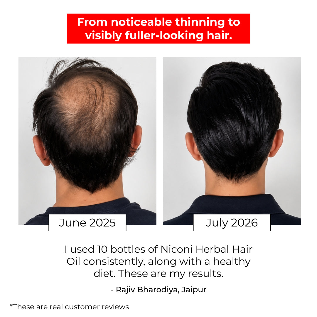 Niconi Herbal Hair Oil | Buy 2 Get ₹1000 OFF