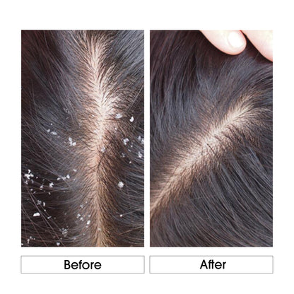 Niconi Anti-Dandruff Shampoo (180ml)